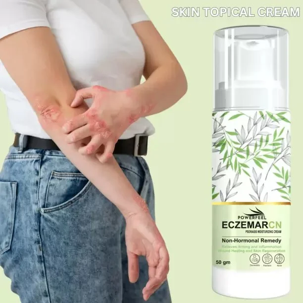 Eczemaron Anti Fungal Cream, Packaging Size: 50 gm