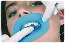 Restore Your Pearly Whites at the Best Tooth Capping Cost